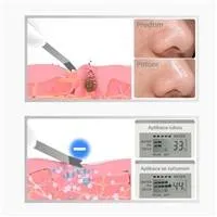 TOUCHBeauty 1887 Ultrazvuková špachtle na pleť