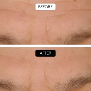 Cocunat Clinical Beauty Filler set proti starnutiu pleti