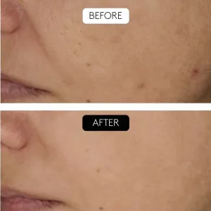 Cocunat Clinical Beauty Filler set proti starnutiu pleti