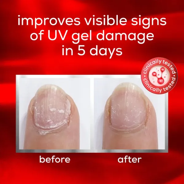 essie to the rescue ošetrujúci lak na nechty na poškodené nechty 13.5 ml