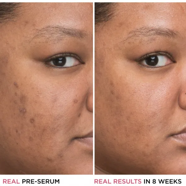 IT Cosmetics Bye Bye Dark Spots zosvetľujúce korekčné sérum proti pigmentovým škvrnám s niacínamidom pre ženy 30 ml