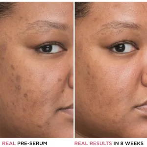 IT Cosmetics Bye Bye Dark Spots zosvetľujúce korekčné sérum proti pigmentovým škvrnám s niacínamidom pre ženy 30 ml
