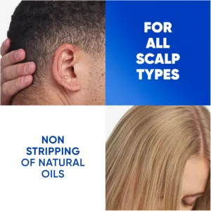 Head & Shoulders Apple Fresh šampón proti lupinám 800 ml