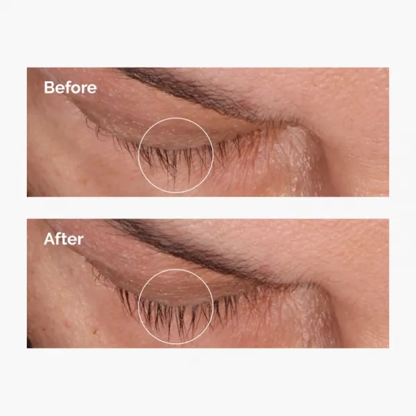 The Ordinary Multi-Peptide Lash and Brow Serum sérum na mihalnice a obočie 5 ml