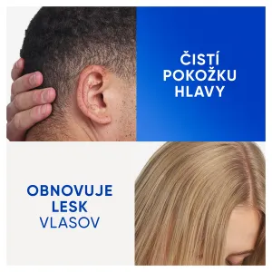 Head & Shoulders Clarify&Shine Apple Cider šampón proti lupinám 400 ml