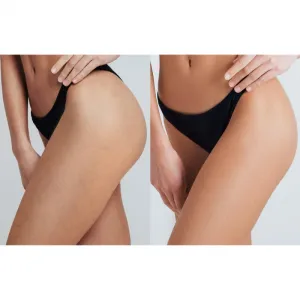 FOREO PEACH™ 2 Pro Max IPL na telo, tvár, oblasť bikín a podpazušia pre ženy 1 ks