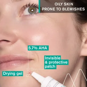 Uriage Hyséac SOS Drying Gel lokálny gél na akné proti nedokonalostiam pleti 15 ml