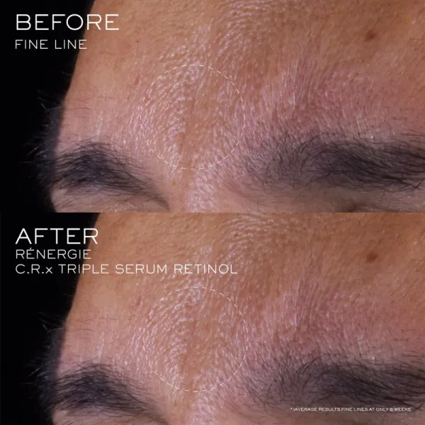 Lancôme Rénergie CRX Triple Serum Retinol pleťové sérum 20 ml