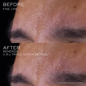 Lancôme Rénergie CRX Triple Serum Retinol pleťové sérum 20 ml