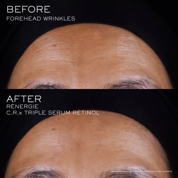 Lancôme Rénergie CRX Triple Serum Retinol pleťové sérum 20 ml