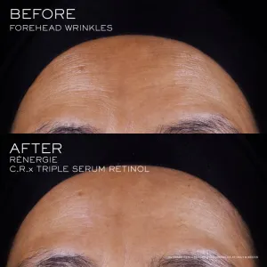Lancôme Rénergie CRX Triple Serum Retinol pleťové sérum 20 ml