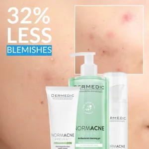 Dermedic Normacne Preventi zmatňujúca hydratačná starostlivosť pre mastnú a zmiešanú pleť 40 ml