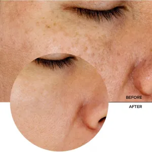 Revox B77 JUST Glycolic Acid 7% jemné exfoliačné tonikum 250 ml