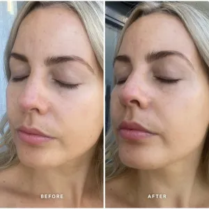 Alpha-H Vitamin E upokojujúce sérum s vitamínom E 25 ml