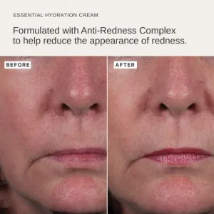 Alpha-H Essential hydratačný krém 50 ml