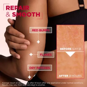 Mixa Urea Cica Repair+ regeneračný telový krém pre veľmi suchú pokožku 150 ml