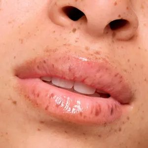 essence lip care hydratačná maska na pery na noc 02 Strawberry Milkshake 8 g