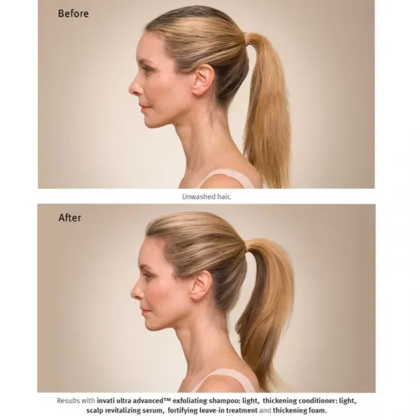 Aveda Invati Ultra Advanced™ Revitalizing Scalp Serum obnovujúce sérum na vlasy a vlasovú pokožku 30 ml