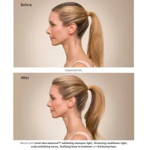 Aveda Invati Ultra Advanced™ Revitalizing Scalp Serum obnovujúce sérum na vlasy a vlasovú pokožku 30 ml
