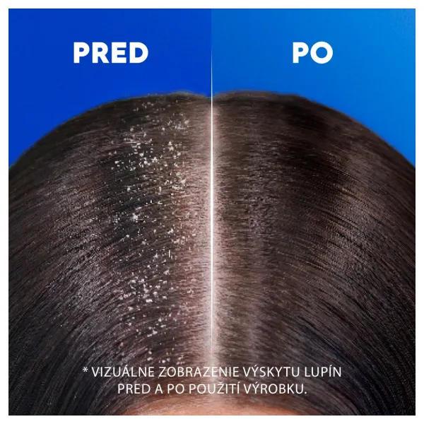Head & Shoulders Deep Hydration šampón