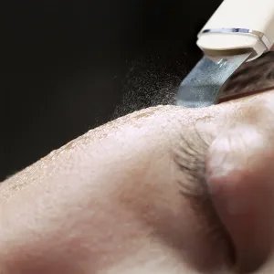 RIO Ultrasonic Skin Cleanser multifunkčná ultrazvuková špachtľa 1 ks