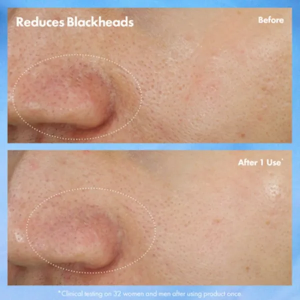 Origins Clear Improvement® Blackhead Clearing Mask-To-Scrub maska na čistenie pórov proti čiernym bodkám 75 ml