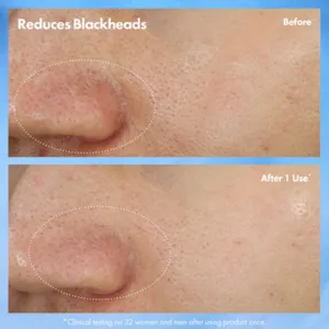 Origins Clear Improvement® Blackhead Clearing Mask-To-Scrub maska na čistenie pórov proti čiernym bodkám 75 ml