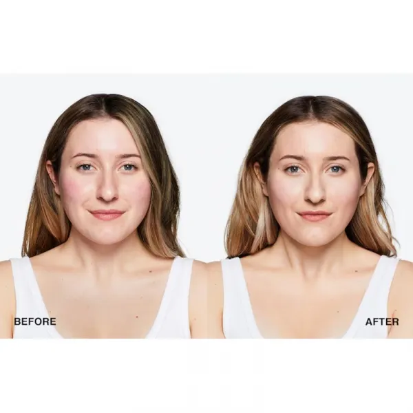 Clinique Moisture Surge™ Sheertint Hydrator SPF 25 tónujúci hydratačný krém SPF 25 odtieň Universal Medium 40 ml