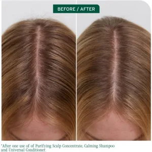 Biolage ScalpSync koncentrát pre pokožku hlavy 200 ml