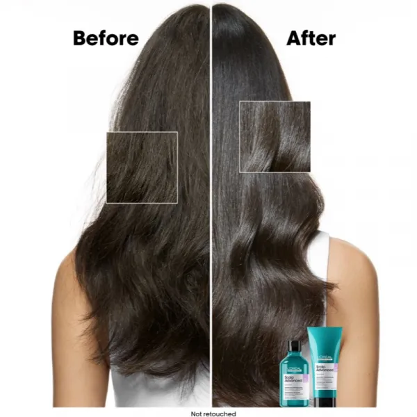 L’Oréal Professionnel Serie Expert Scalp Advanced šampón pre citlivú a podráždenú pokožku hlavy 500 ml