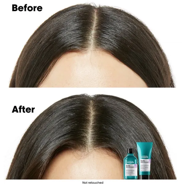 L’Oréal Professionnel Serie Expert Scalp Advanced šampón pre citlivú a podráždenú pokožku hlavy 500 ml