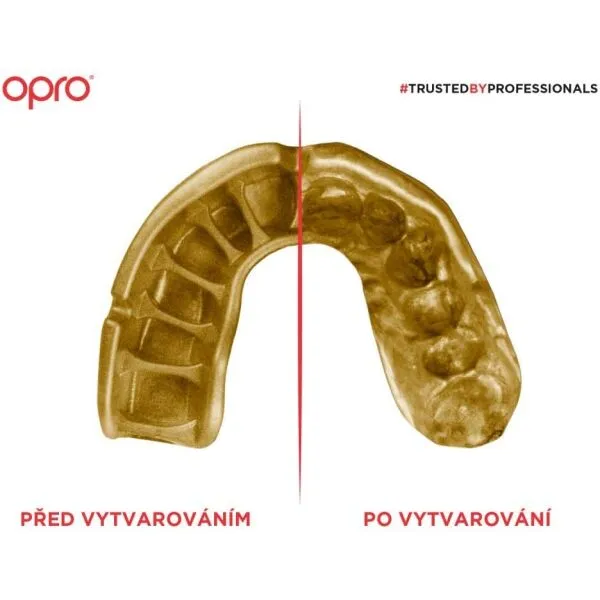 Opro GOLD Chránič zubov, transparentná, veľkosť UNI
