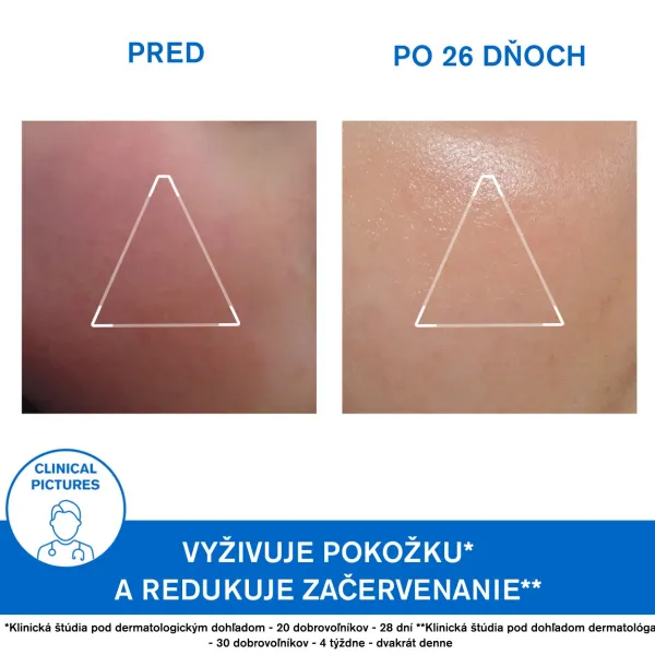 Uriage Xémose Face Cream výživný krém pre veľmi suchú a citlivú pleť 40 ml