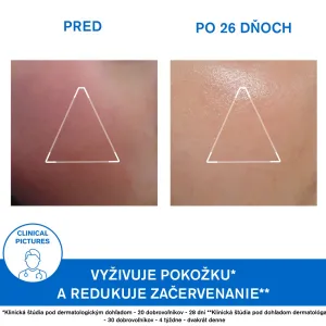 Uriage Xémose Face Cream výživný krém pre veľmi suchú a citlivú pleť 40 ml