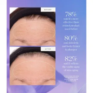 KORA Organics Plant Stem Cell Retinol Alternative Serum pleťové sérum s retinolom 30 ml