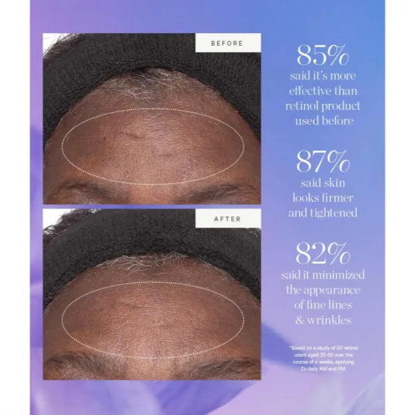 KORA Organics Plant Stem Cell Retinol Alternative Moisturizer hydratačný krém s retinolom 15 ml