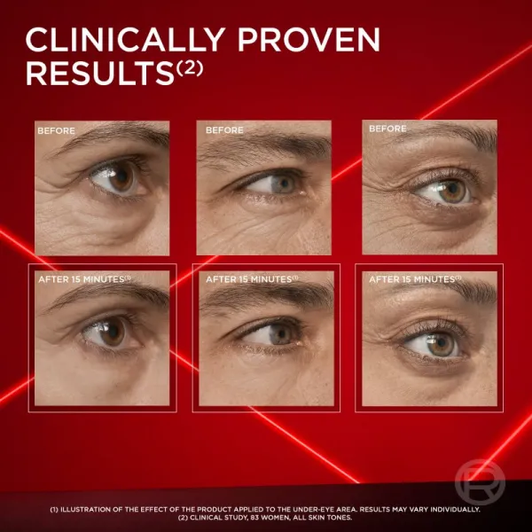 L’Oréal Paris Revitalift Laser očná starostlivosť proti opuchom a tmavým kruhom 15 ml