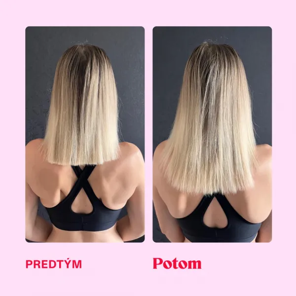 LOVE is in the HAIR - Healthy hair gummies