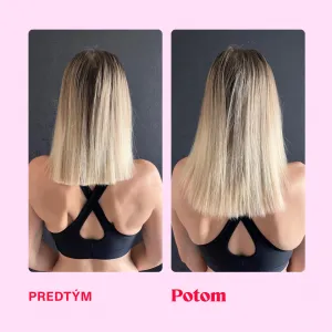 LOVE is in the HAIR - Healthy hair gummies