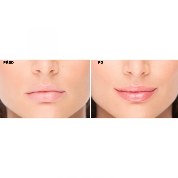 FacEvolution LipPlus Booster starostlivosť pre zväčšenie objemu pier odtieň Transparent 5 ml
