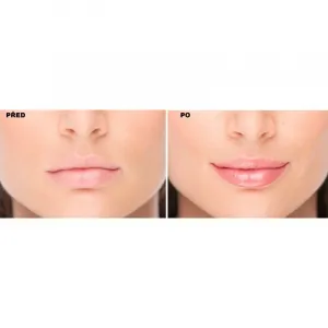 FacEvolution LipPlus Booster starostlivosť pre zväčšenie objemu pier odtieň Transparent 5 ml