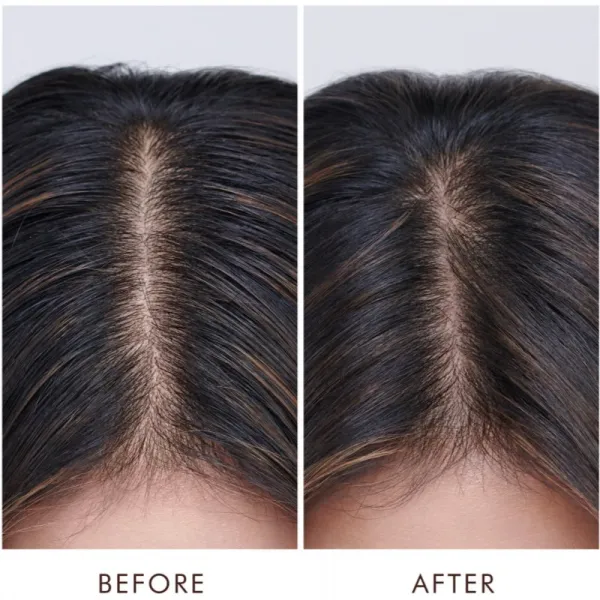 Moroccanoil Treatment Oily vlasová kúra pre mastnú pokožku hlavy 45 ml