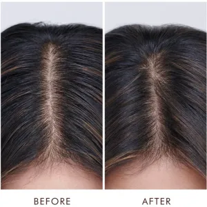 Moroccanoil Treatment Oily vlasová kúra pre mastnú pokožku hlavy 45 ml
