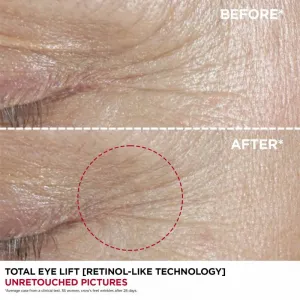 Clarins Total Eye Lift očný krém proti vráskam 15 ml