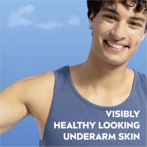NIVEA Derma Control Defend antiperspirant v spreji 72h 150 ml