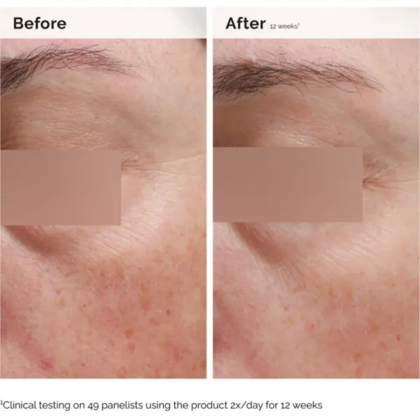 The Ordinary Niacinamide 5% Face & Body Emulsion ľahká hydratačná emulzia proti tmavým škvrnám na tvár a telo 100 ml