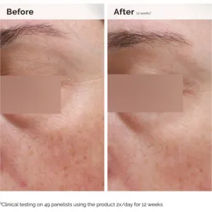 The Ordinary Niacinamide 5% Face & Body Emulsion ľahká hydratačná emulzia proti tmavým škvrnám na tvár a telo 100 ml