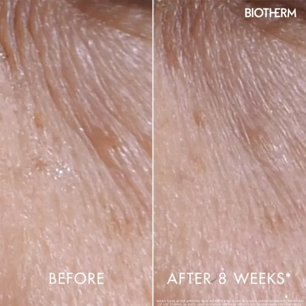 Biotherm Blue Peptides Eyes Lips Contour Reshaper starostlivosť o očné okolie a pery 15 ml