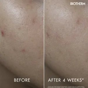 Biotherm Aquasource+ Vitamin Glow Gel pleťový gél 30 ml