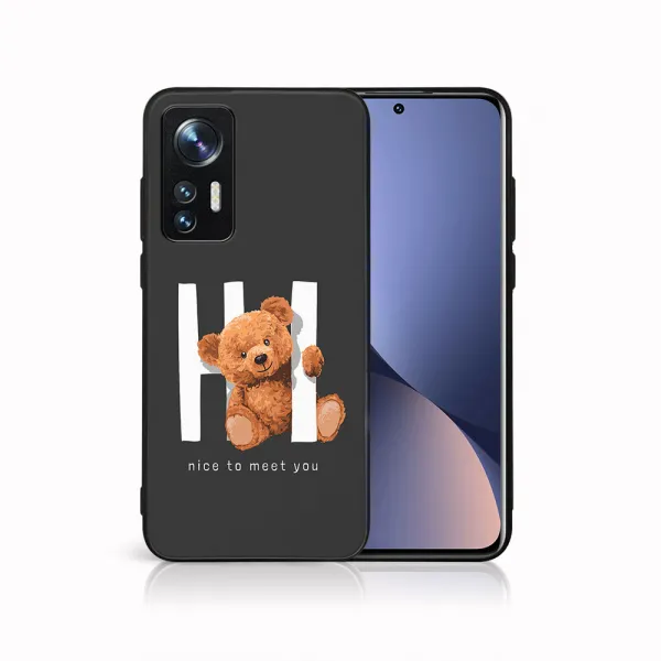 MY ART Ochranný kryt pre Xiaomi 12 Lite HI (182)